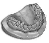 Scannergebnis Streifenlichtscanner Scanner