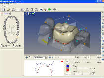 Software SmartDesigner cad cam dental medelliersoftware