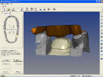 SmartDesigner Dental CAD CAM Software  Milling Zirkon Teeth